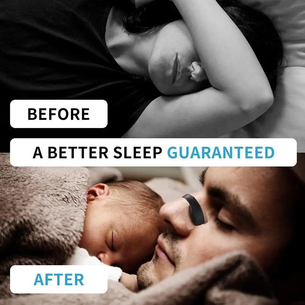 eelhoe Nasal Breathing Dilator – BOH8925A Starter Kit