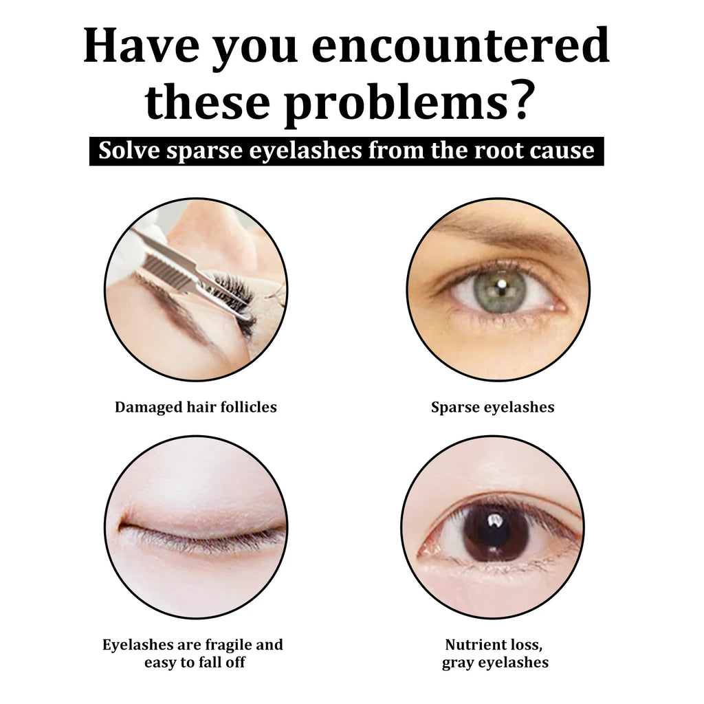 eelhoe Eyelash & Eyebrow Growth Treatment